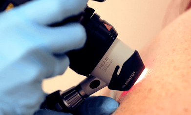 Diagnosemethoden für Plantarwarzen