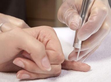 Durchführung einer Lasertherapie.